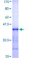 USP6 / HRP1 Protein - 12.5% SDS-PAGE Stained with Coomassie Blue.