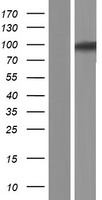 USP6NL Protein - Western validation with an anti-DDK antibody * L: Control HEK293 lysate R: Over-expression lysate