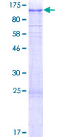 USP6NL Protein - 12.5% SDS-PAGE of human USP6NL stained with Coomassie Blue