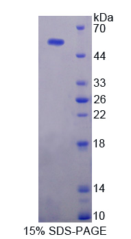 USP7 / HAUSP Protein - Recombinant  Ubiquitin Specific Peptidase 7 By SDS-PAGE