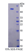 USP7 / HAUSP Protein - Recombinant  Ubiquitin Specific Peptidase 7 By SDS-PAGE