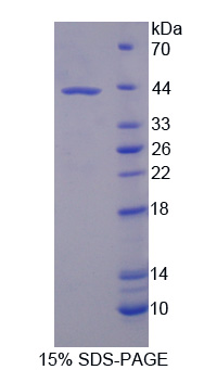 USP8 / UBPY Protein - Recombinant Ubiquitin Specific Peptidase 8 By SDS-PAGE