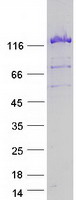 USP8 / UBPY Protein - Purified recombinant protein USP8 was analyzed by SDS-PAGE gel and Coomassie Blue Staining
