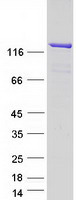 USP8 / UBPY Protein - Purified recombinant protein USP8 was analyzed by SDS-PAGE gel and Coomassie Blue Staining