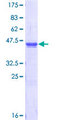 USP9X / FAM Protein - 12.5% SDS-PAGE Stained with Coomassie Blue.