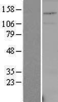 USPL1 Protein - Western validation with an anti-DDK antibody * L: Control HEK293 lysate R: Over-expression lysate