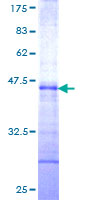 USPL1 Protein - 12.5% SDS-PAGE Stained with Coomassie Blue.