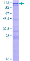UTP14A Protein - 12.5% SDS-PAGE of human UTP14A stained with Coomassie Blue