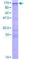 UTP14A Protein - 12.5% SDS-PAGE of human UTP14A stained with Coomassie Blue