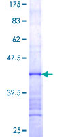 UTP14A Protein - 12.5% SDS-PAGE Stained with Coomassie Blue.
