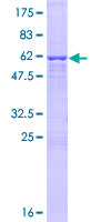 UTP15 Protein - 12.5% SDS-PAGE of human UTP15 stained with Coomassie Blue