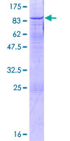 UTP18 Protein - 12.5% SDS-PAGE of human UTP18 stained with Coomassie Blue