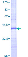 UTP20 Protein - 12.5% SDS-PAGE Stained with Coomassie Blue.