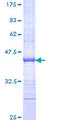 UTP20 Protein - 12.5% SDS-PAGE Stained with Coomassie Blue.