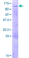 UTP3 / CRLZ1 Protein - 12.5% SDS-PAGE of human UTP3 stained with Coomassie Blue