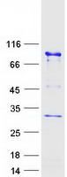 UTP3 / CRLZ1 Protein - Purified recombinant protein UTP3 was analyzed by SDS-PAGE gel and Coomassie Blue Staining