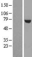 UTP6 Protein - Western validation with an anti-DDK antibody * L: Control HEK293 lysate R: Over-expression lysate