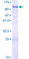 UTP6 Protein - 12.5% SDS-PAGE of human UTP6 stained with Coomassie Blue