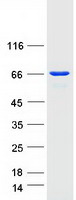 UTP6 Protein - Purified recombinant protein UTP6 was analyzed by SDS-PAGE gel and Coomassie Blue Staining