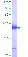 UTRN / Utrophin Protein - 12.5% SDS-PAGE Stained with Coomassie Blue.
