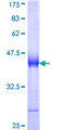 UTRN / Utrophin Protein - 12.5% SDS-PAGE Stained with Coomassie Blue.