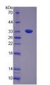 UTRN / Utrophin Protein - Recombinant  Utrophin By SDS-PAGE