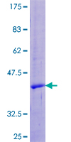 UTS2 / Urotensin II Protein - 12.5% SDS-PAGE of human UTS2 stained with Coomassie Blue