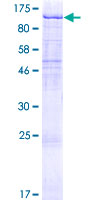 UVRAG Protein - 12.5% SDS-PAGE of human UVRAG stained with Coomassie Blue