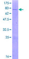 UXS1 Protein - 12.5% SDS-PAGE of human UXS1 stained with Coomassie Blue