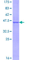 UXT Protein - 12.5% SDS-PAGE of human UXT stained with Coomassie Blue