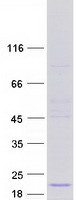 UXT Protein - Purified recombinant protein UXT was analyzed by SDS-PAGE gel and Coomassie Blue Staining