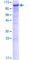 VAC14 / TRX Protein - 12.5% SDS-PAGE of human VAC14 stained with Coomassie Blue