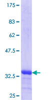 VAC14 / TRX Protein - 12.5% SDS-PAGE Stained with Coomassie Blue.