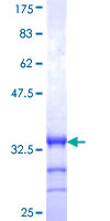 VAMP1 / VAMP-1 Protein - 12.5% SDS-PAGE Stained with Coomassie Blue.