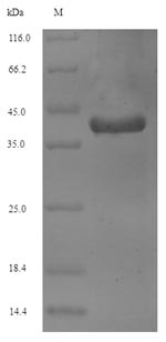 VAMP2 / VAMP-2 Protein - (Tris-Glycine gel) Discontinuous SDS-PAGE (reduced) with 5% enrichment gel and 15% separation gel.