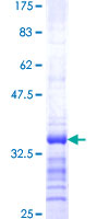 VAMP5 / VAMP-5 Protein - 12.5% SDS-PAGE Stained with Coomassie Blue.