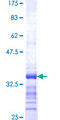 VAMP5 / VAMP-5 Protein - 12.5% SDS-PAGE Stained with Coomassie Blue.