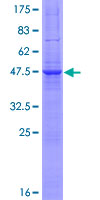 VAMP7 / SYBL1 / T1 VAMP Protein - 12.5% SDS-PAGE of human SYBL1 stained with Coomassie Blue