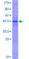 VAMP7 / SYBL1 / T1 VAMP Protein - 12.5% SDS-PAGE of human SYBL1 stained with Coomassie Blue