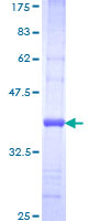 VAMP7 / SYBL1 / T1 VAMP Protein - 12.5% SDS-PAGE Stained with Coomassie Blue.