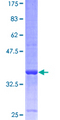 VAMP8 / VAMP-8 Protein - 12.5% SDS-PAGE of human VAMP8 stained with Coomassie Blue