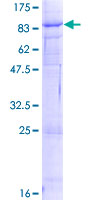 VANGL1 Protein - 12.5% SDS-PAGE of human VANGL1 stained with Coomassie Blue