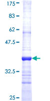 VANGL1 Protein - 12.5% SDS-PAGE Stained with Coomassie Blue