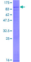 VANGL2 / LTAP Protein - 12.5% SDS-PAGE of human VANGL2 stained with Coomassie Blue
