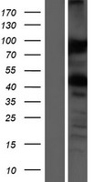 VAP33 / VAPA Protein - Western validation with an anti-DDK antibody * L: Control HEK293 lysate R: Over-expression lysate