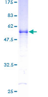 VAP33 / VAPA Protein - 12.5% SDS-PAGE of human VAPA stained with Coomassie Blue