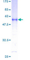 VAP33 / VAPA Protein - 12.5% SDS-PAGE of human VAPA stained with Coomassie Blue