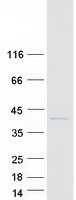 VAP33 / VAPA Protein - Purified recombinant protein VAPA was analyzed by SDS-PAGE gel and Coomassie Blue Staining