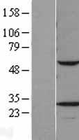 VAPB Protein - Western validation with an anti-DDK antibody * L: Control HEK293 lysate R: Over-expression lysate
