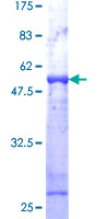 VAPB Protein - 12.5% SDS-PAGE of human VAPB stained with Coomassie Blue